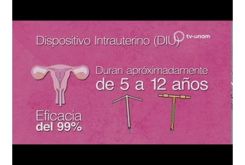 Métodos anticonceptivos, ¡conócelos!