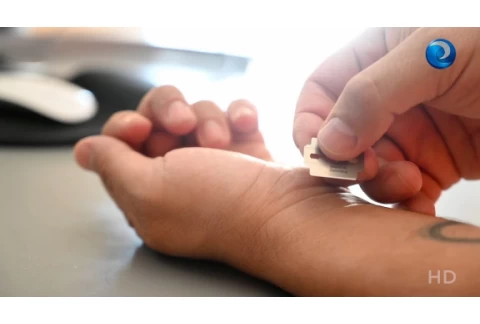 Autolesiones: detectar y frenar esta conducta