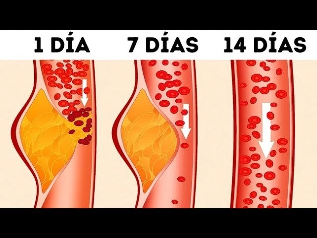 Imagen portada ¿Qué es la dieta DASH y por qué los médicos la llaman una de las mejores?