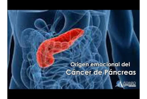 Origen Emocional del Cáncer de Páncreas